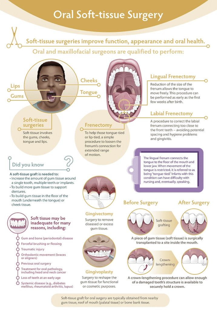 Oral Soft tissue surgery