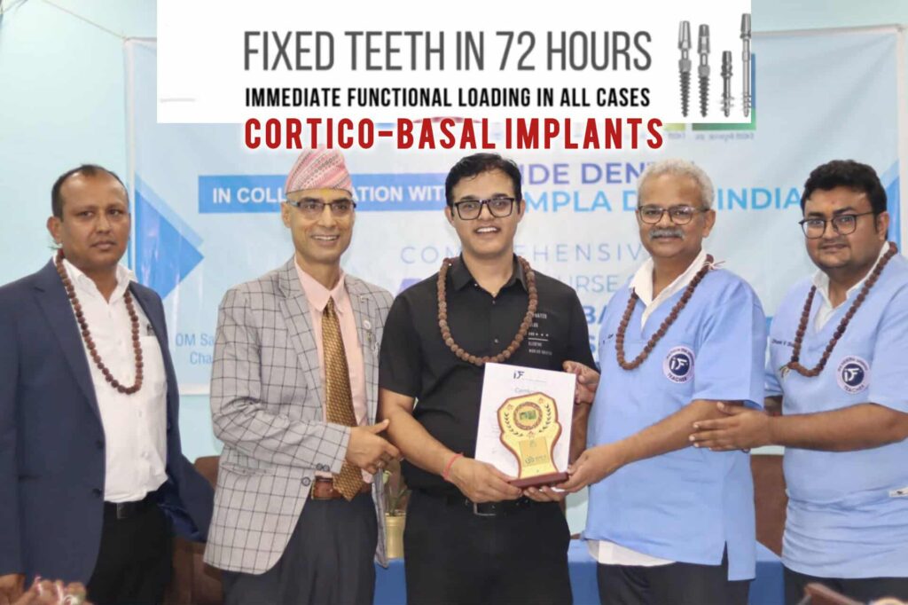 Comprehensive Training on Cortico-Basal Implant
